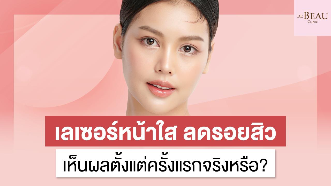 เลเซอร์หน้าใส ลดรอยสิว เห็นผลตั้งแต่ครั้งแรกจริงหรือ?