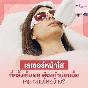 เลเซอร์หน้าใส กี่ครั้งเห็นผล ต้องทำบ่อยมั้ย เหมาะกับใครบ้าง?