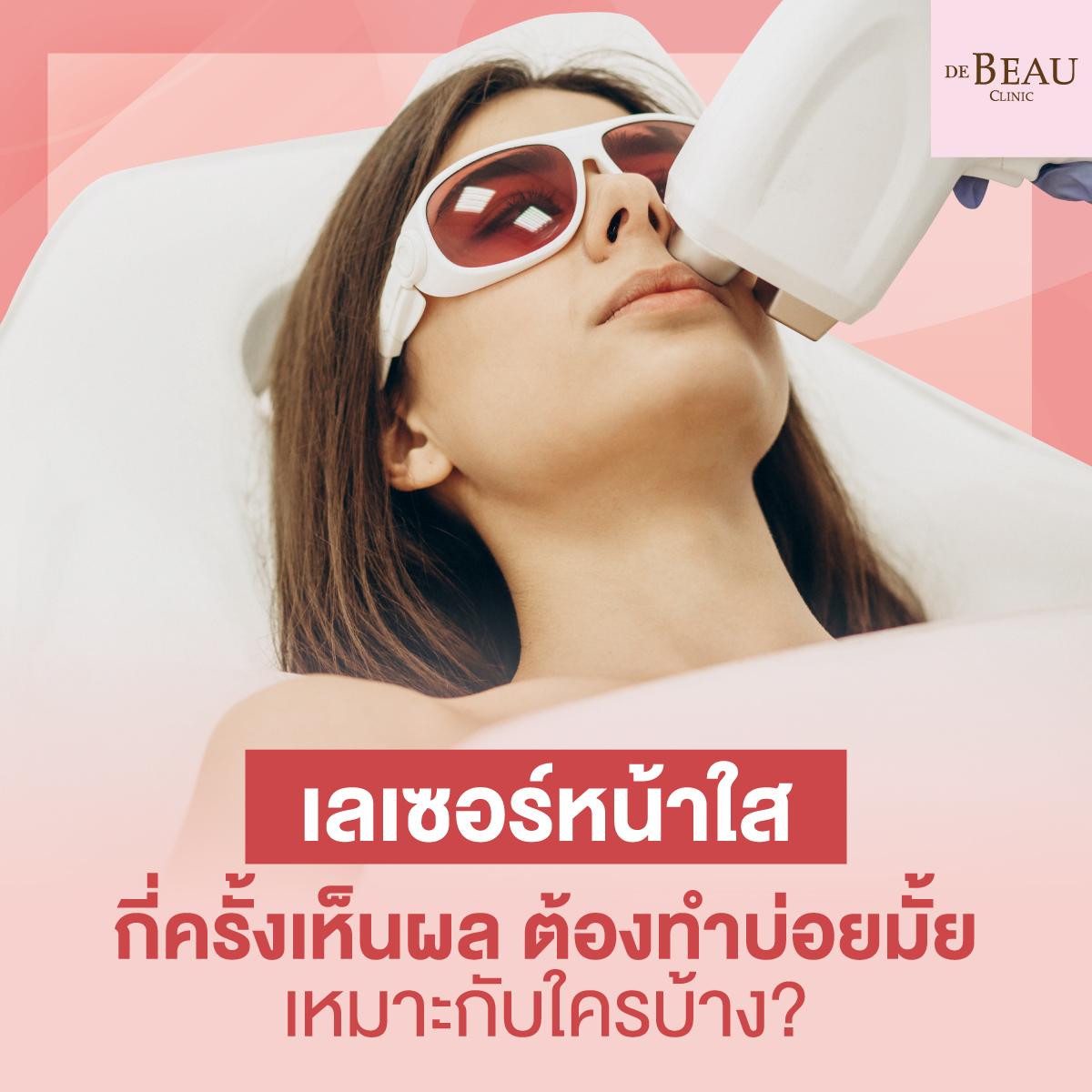 เลเซอร์หน้าใส กี่ครั้งเห็นผล ต้องทำบ่อยมั้ย เหมาะกับใครบ้าง?