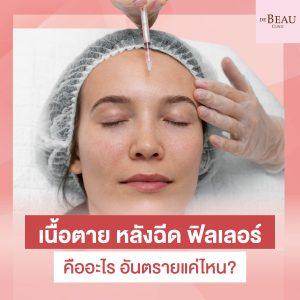 เนื้อตาย หลังฉีด ฟิลเลอร์ คืออะไร อันตรายแค่ไหน?