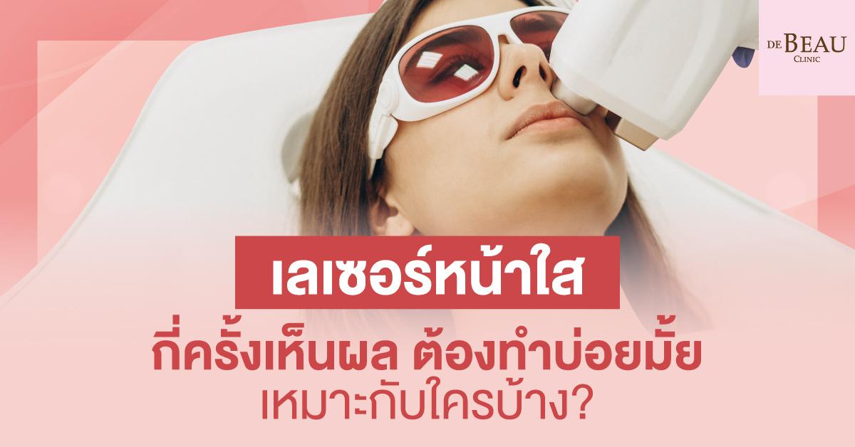 เลเซอร์หน้าใส กี่ครั้งเห็นผล ต้องทำบ่อยมั้ย เหมาะกับใครบ้าง?