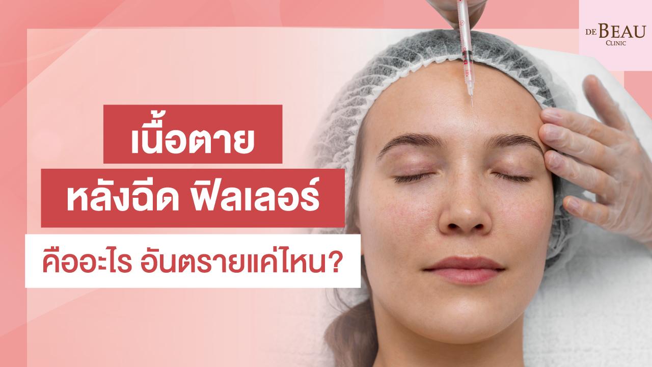 เนื้อตาย หลังฉีด ฟิลเลอร์ คืออะไร อันตรายแค่ไหน?