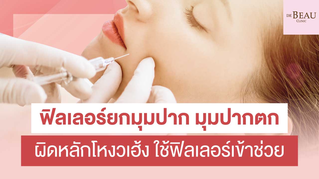 ฟิลเลอร์ยกมุมปาก มุมปากตก ผิดหลักโหงวเฮ้ง ใช้ฟิลเลอร์เข้าช่วย