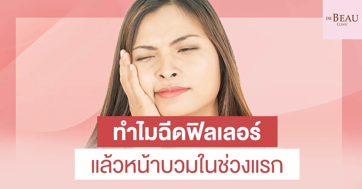 ฉีดฟิลเลอร์แล้วหน้าบวม