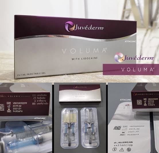 juvederm filler