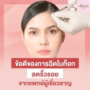 ฉีดโบท็อกลดริ้วรอย
