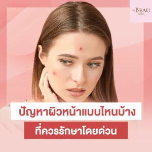 ปัญหาผิวหน้า