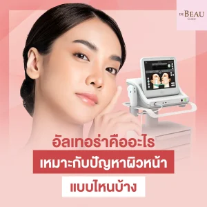 อัลเทอร่าคือ