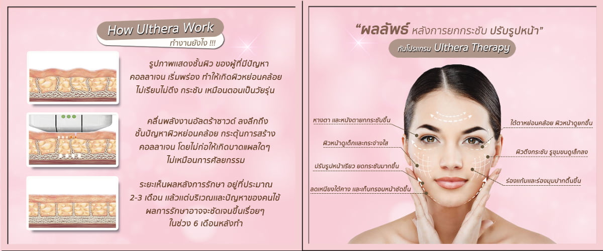 ผลลัพธ์หลังการยกกระชับ Ulthera