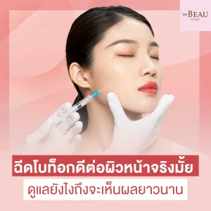 ฉีดโบท็อก