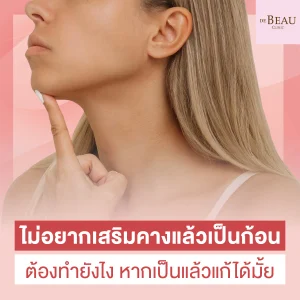 เสริมคางแล้วเป็นก้อน