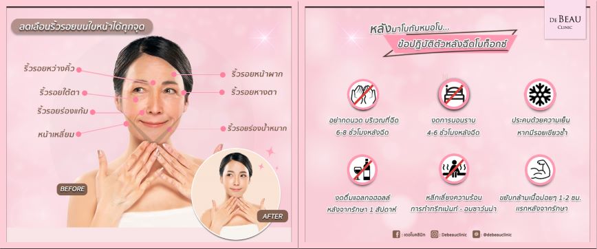 De BEAU CLINIC Botox