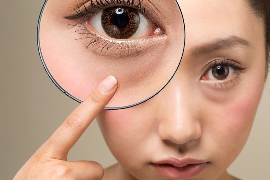 ฉีดฟิลเลอร์ใต้ตาหรือฉีด Cytocare ดี?