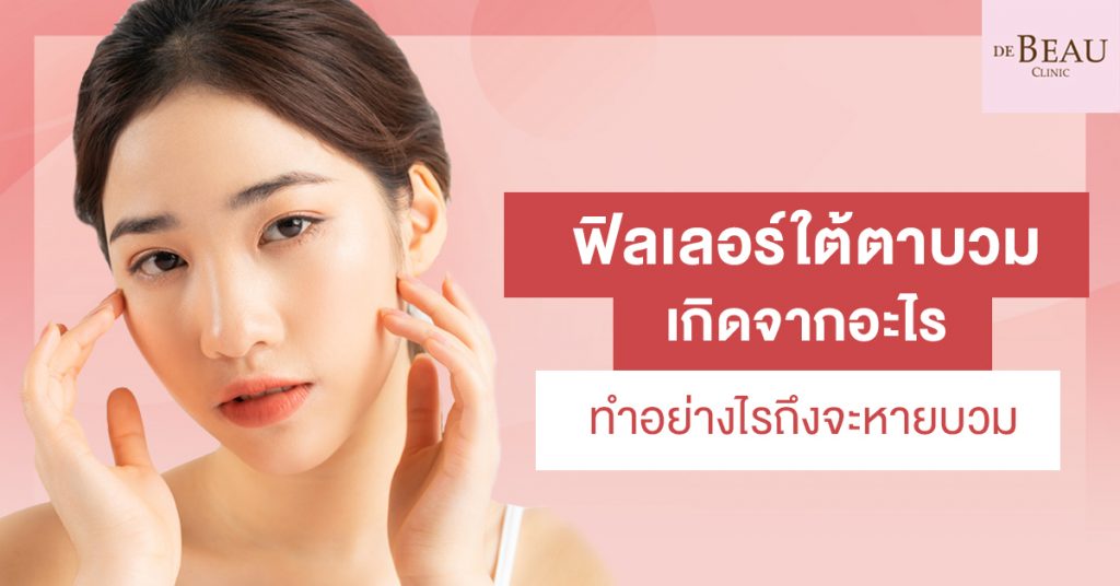 ฟิลเลอร์ใต้ตาบวม