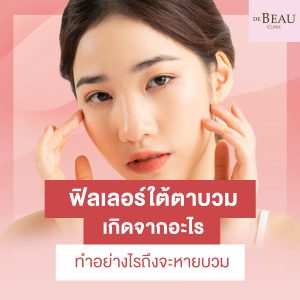 ฟิลเลอร์ใต้ตาบวม