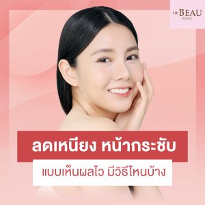 ลดเหนียง
