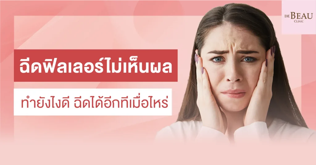 ฉีดฟิลเลอร์ไม่เห็นผล