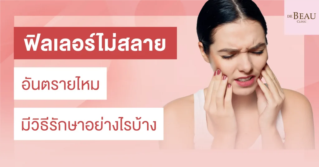 ฟิลเลอร์ไม่สลาย