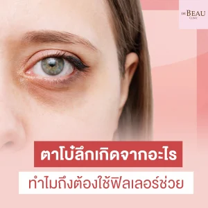 ตาโบ๋ลึก