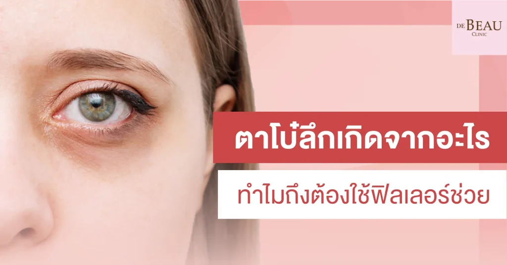 ตาโบ๋ลึก