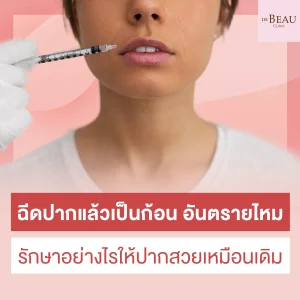 ฉีดปากแล้วเป็นก้อน