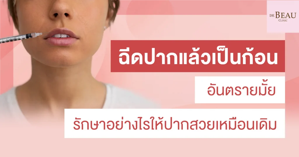 ฉีดปากแล้วเป็นก้อน