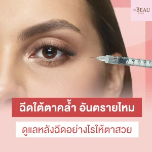 ฉีดใต้ตาคล้ำ