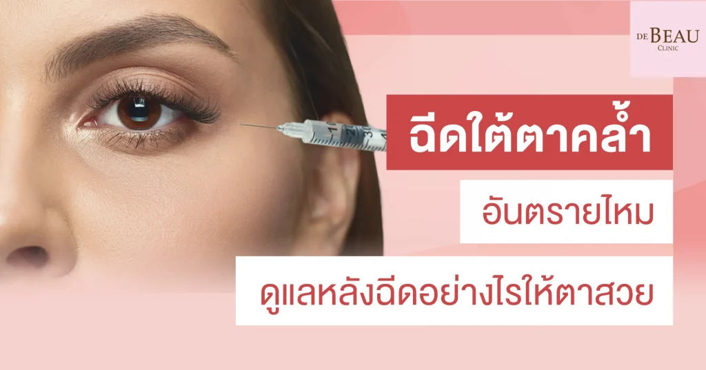 ฉีดใต้ตาคล้ำ