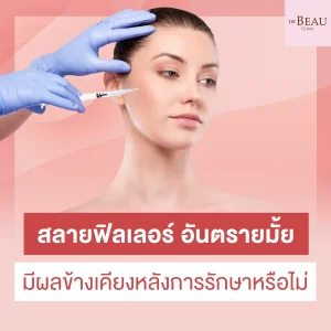 สลายฟิลเลอร์