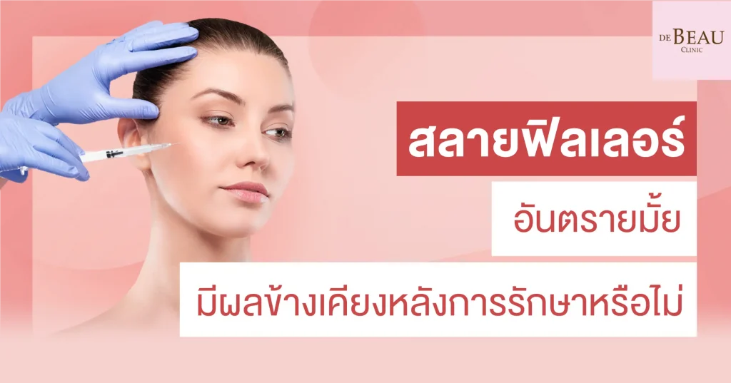 สลายฟิลเลอร์