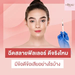 ฉีดสลายฟิลเลอร์