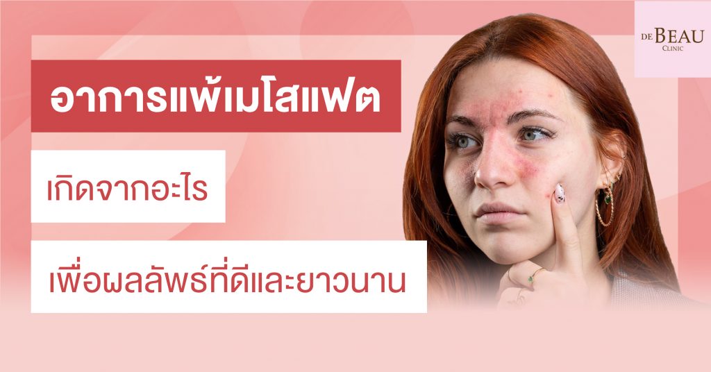 อาการแพ้เมโสแฟต