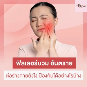 ฟิลเลอร์บวม