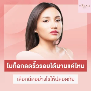 โบท็อกซ์ลดริ้วรอย