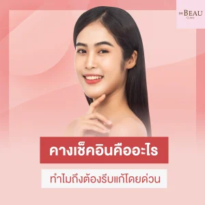 คางเช็คอิน