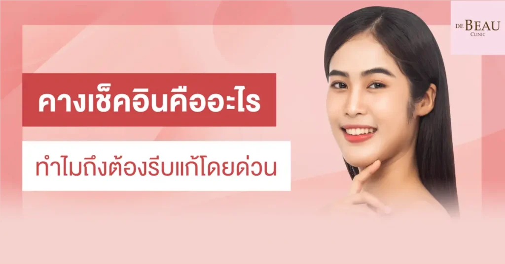 คางเช็คอิน