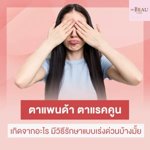 ตาแพนด้า