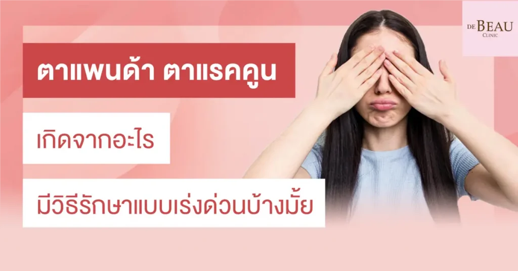 ตาแพนด้า