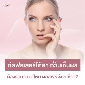 ฉีดฟิลเลอร์ใต้ตากี่วันเห็นผล