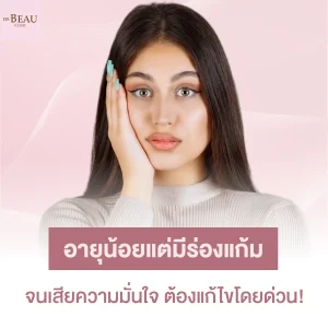 อายุน้อยแต่มีร่องแก้ม