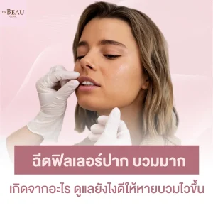 ฉีดฟิลเลอร์ปาก บวมมาก เกิดจากอะไร ดูแลยังไงดีให้หายบวมไวขึ้น