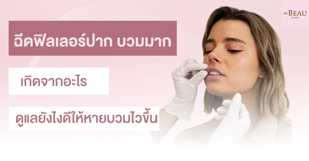 ฉีดฟิลเลอร์ปาก บวมมาก เกิดจากอะไร ดูแลยังไงดีให้หายบวมไวขึ้น