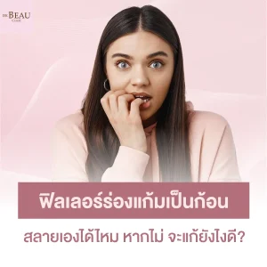 ฟิลเลอร์ร่องแก้ม เป็นก้อน สลายเองได้ไหม หากไม่ จะแก้ยังไงดี?