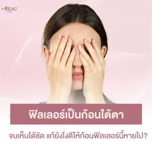ฟิลเลอร์เป็นก้อนใต้ตา จนเห็นได้ชัด แก้ยังไงดีให้ก้อนฟิลเลอร์นี้หายไป?