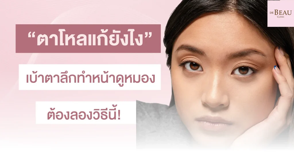 ตาโหล แก้ยังไง เบ้าตาลึก ทำหน้าดูหมอง ต้องลองวิธีนี้!