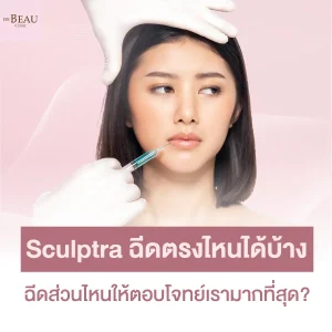 Sculptra ฉีดตรงไหนได้บ้าง ฉีดส่วนไหนให้ตอบโจทย์เรามากที่สุด?