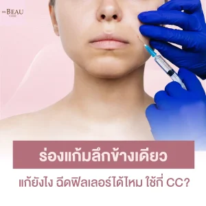 ร่องแก้มลึกข้างเดียว แก้ยังไง ฉีดฟิลเลอร์ได้ไหม ใช้กี่ CC?